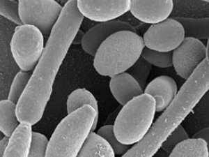 PEŞEW  WE  JYNS  ÝOLLARYNYŇ  KÖMELEKLI  KESELI