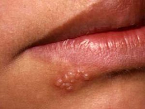 UÇUK  ÝOKANÇLYGYNYŇ  KÖP  DÜRLÜLIGI