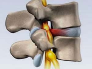 OŇURGARA  INGISINIŇ  ALAMATLARY  WE  SEBÄPLERI