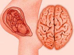 ENE-ATALAR, ÜNS BERIŇ: PERINATAL ENSEFALOPATIÝA