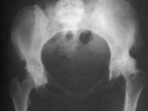 AÝAL JYNS AGZALARYNYŇ INÇEKESELI: GÖRNÜŞLERI WE ANYKLAÝYŞ ÇÄRELERI