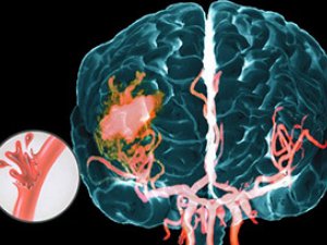 INSULT: SEBÄPLERI, GÖRNÜŞLERI, ILKINJI KÖMEK