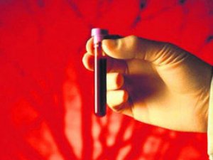 GANAZLYLYK: DOGRY IÝMITLENMÄNIŇ ÄHMIÝETI WE DERMAN SERIŞDELERI