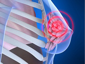 MASTOPATIÝA: SEBÄBI, GÖRNÜŞLERI, ALAMATLARY WE BEJERGI ÇÄRELERI