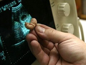 MEKDEPDE AÝDYLMAÝAN WE SAPAKDA ÖWREDILMEÝÄN MESELE