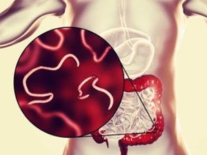 GURÇUGY NÄHILI BEJERIP BOLÝAR?