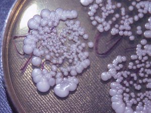 JYNSHANANYŇ KÖMELEKLI ZEPERLENMESI NÄMEDEN DÖREÝÄR?