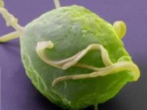 WENERIKI  KESELLER:  TRIHOMONIAZ  (TRIHOMONOZ)