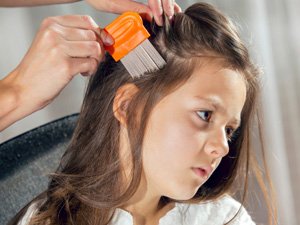 ÇAGAŇ SAÇY BITLEDIMI? OŇA NÄDIP HOWSALA DÜŞMEZDEN ÇÄRE GÖRMELI?*